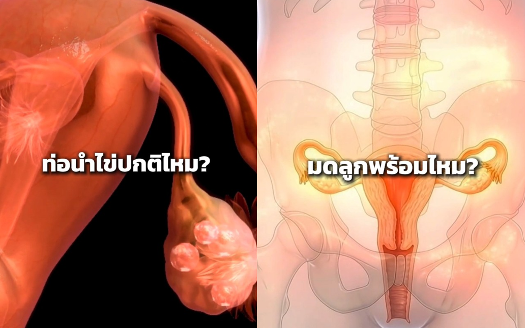 ประจำเดือนมาสม่ำเสมอ แต่ไม่ท้อง